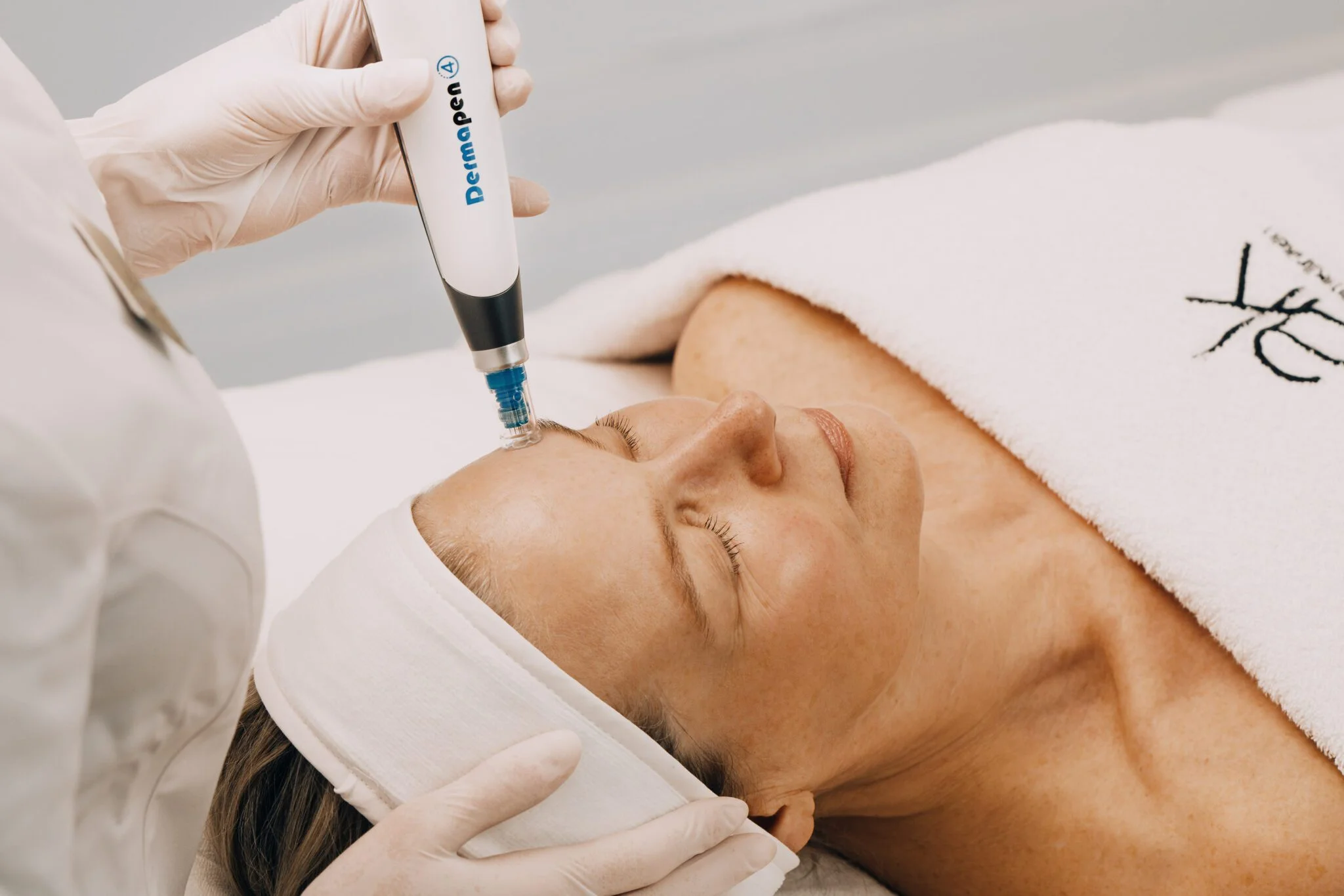 Dermapen microneedling