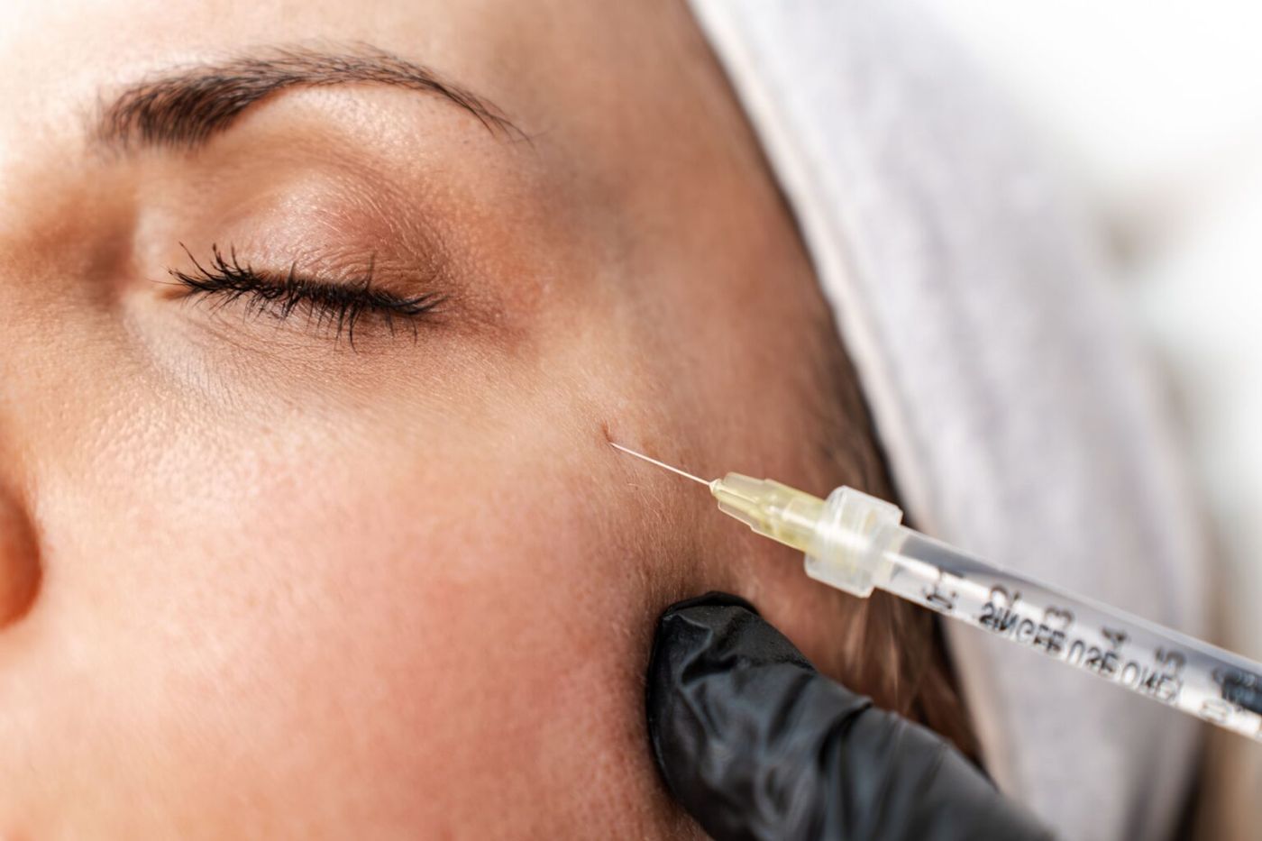 Profhilo-injeksjon ved Cosmetica Klinikken