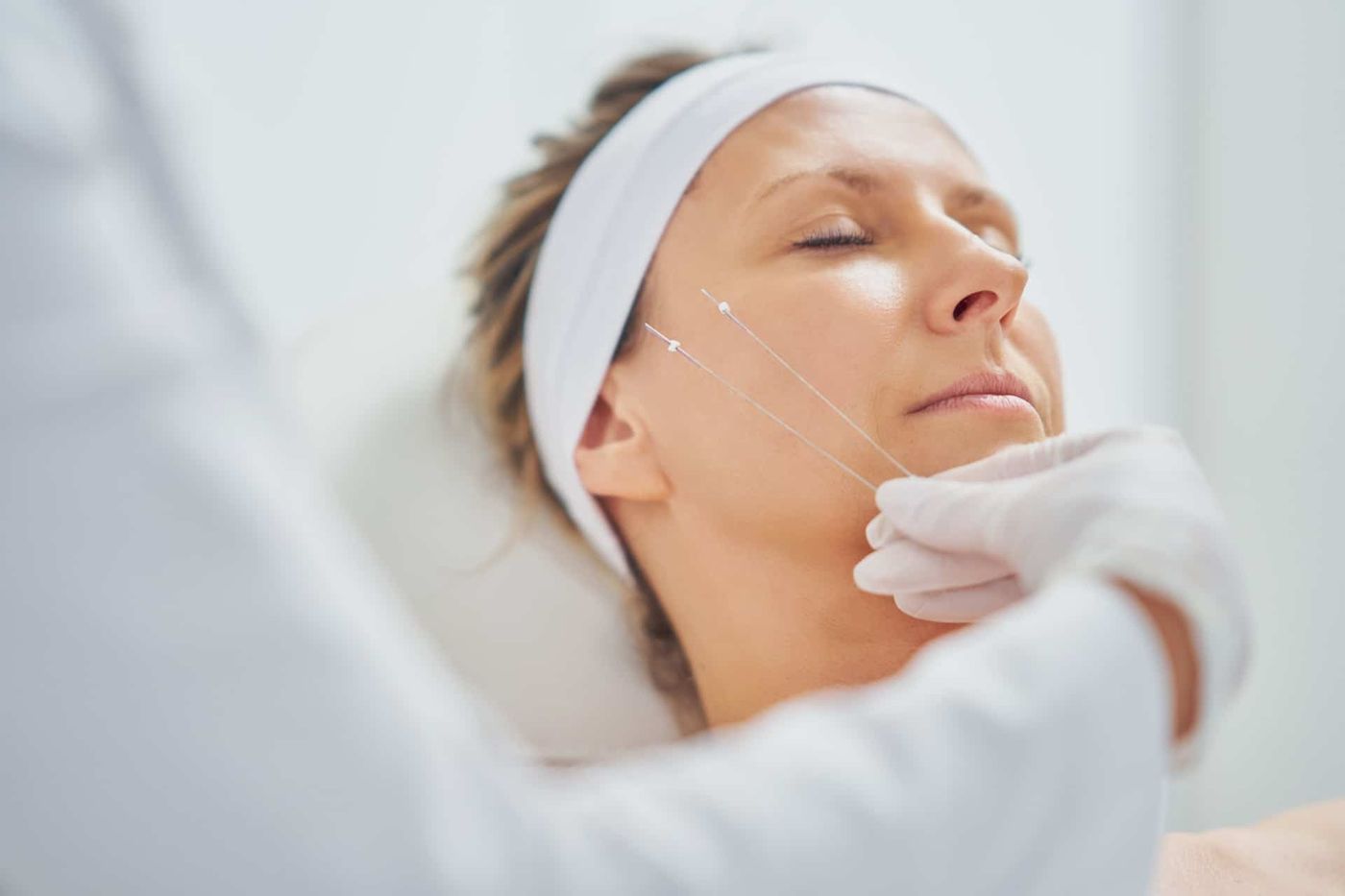 Trådløft ved Cosmetica Klinikken