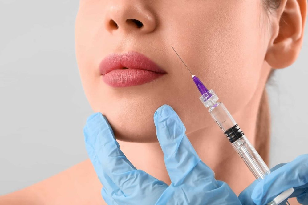 Fillerbehandling ved Cosmeticaklinikken