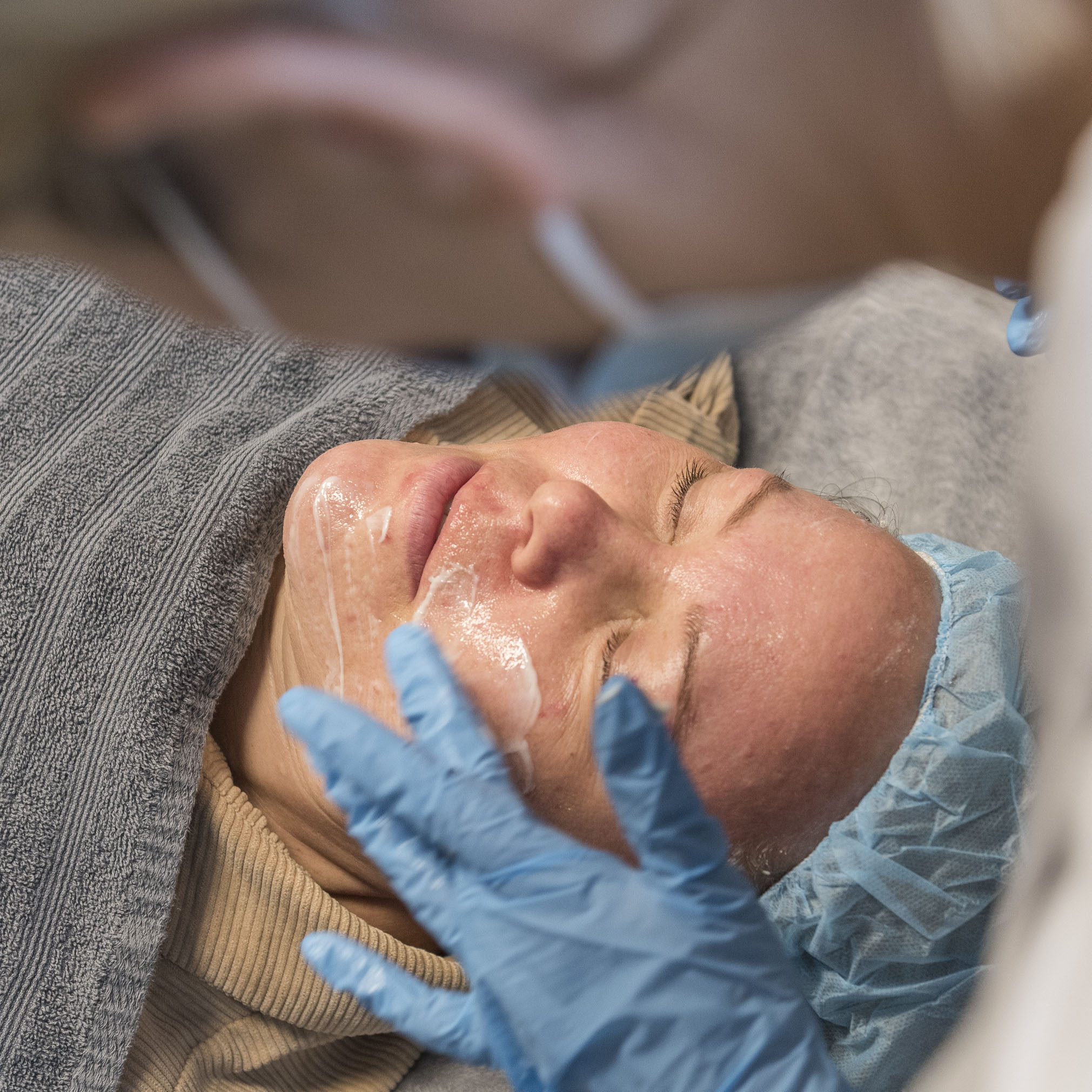 Ansiktsbehandling hos Frogner Hudklinikk