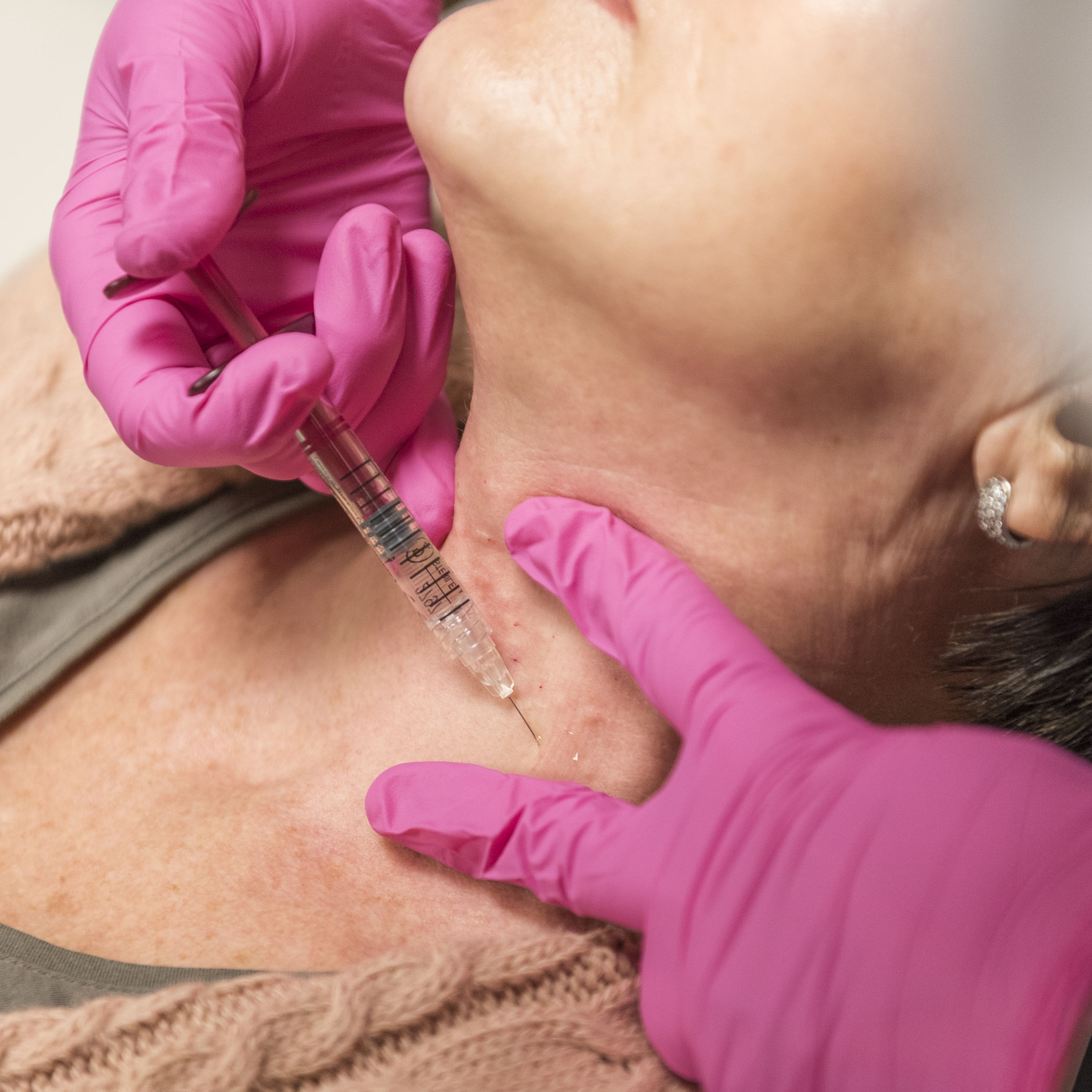 Injeksjonsbehandling hos Frogner Hudklinikk