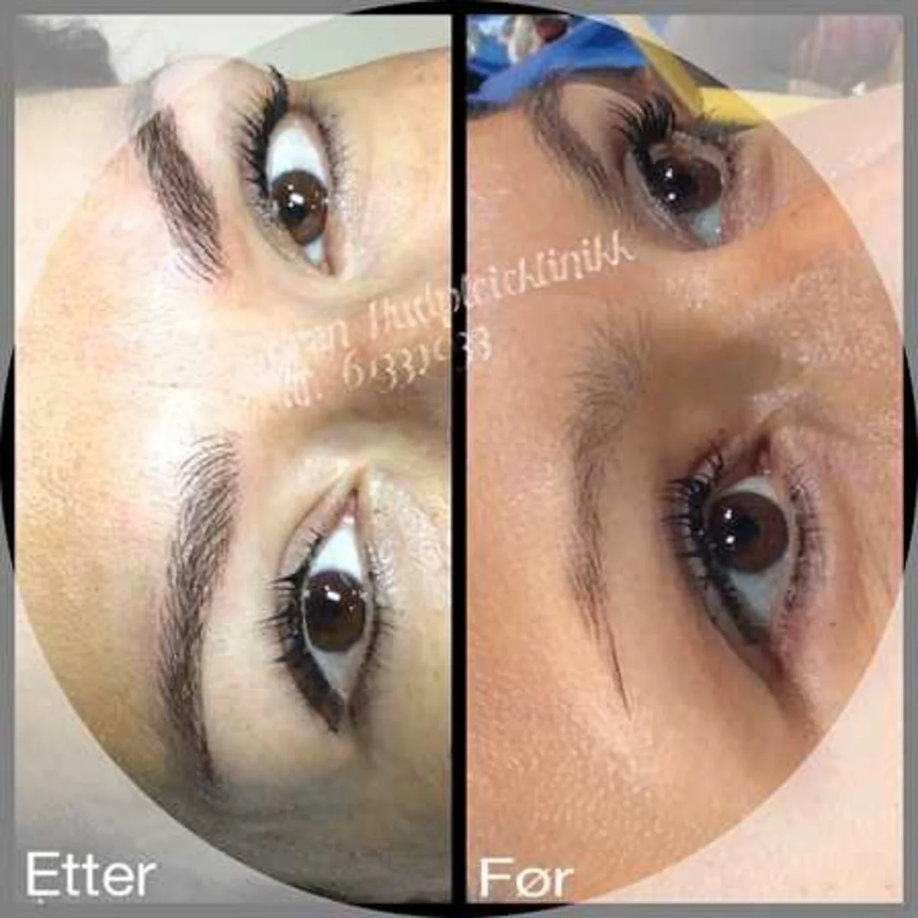 Microblading av bryn, etter og før