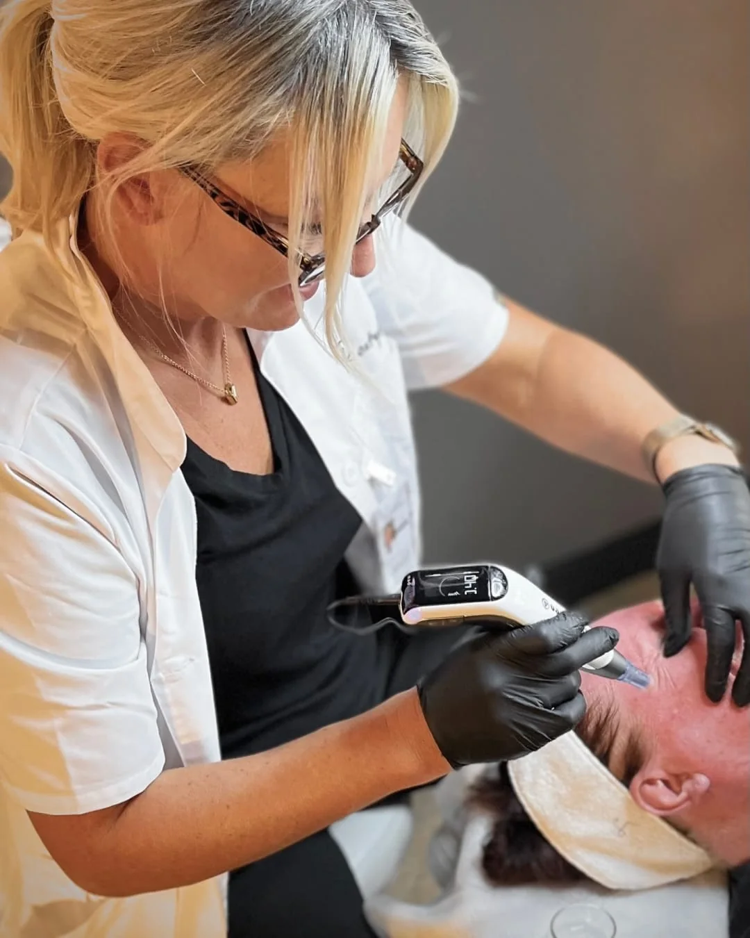 Fotona laserbehandling av ansikt