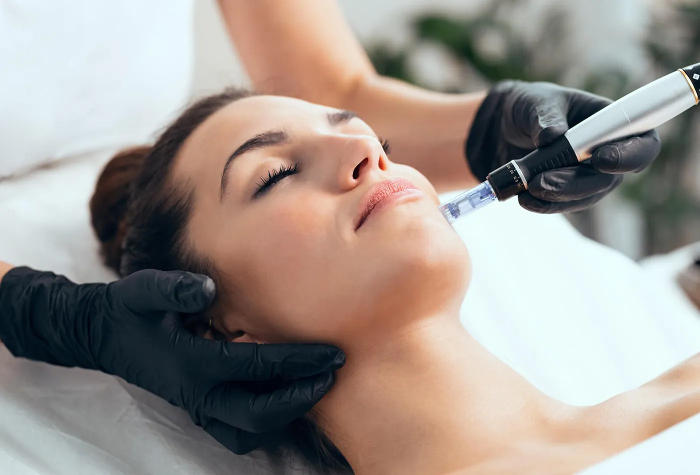 Microneedling utf&oslash;rt med dermapen